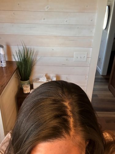 Customer photo review of Day After Brush Clean Dry Shampoo