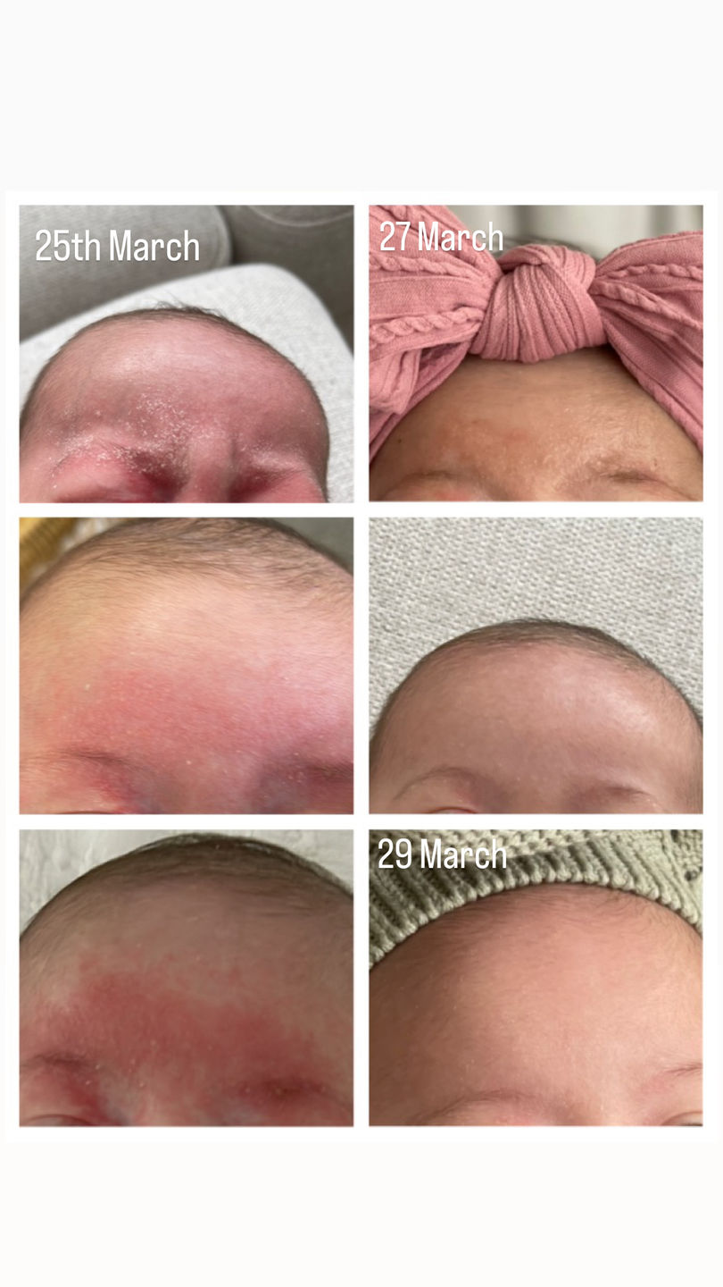 Customer photo review of Organic Barrier Balm
