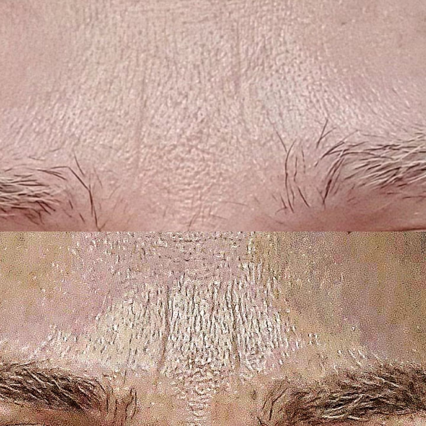Customer photo review of Granactive Retinoid* 2% Emulsion 30ml