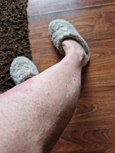 Customer photo review of Multi Strain Biotic