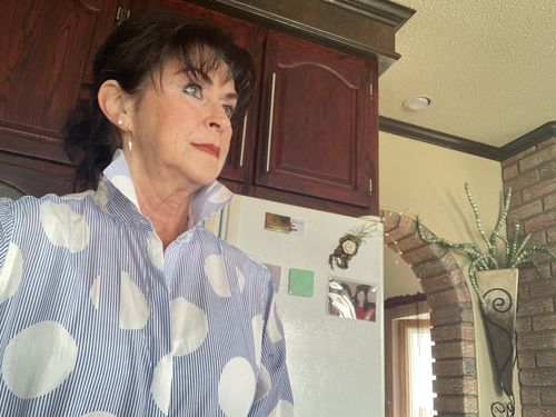 Customer photo review of EvenSkyn® Lumo: Premium Anti-Aging & Skin Tightening Handset