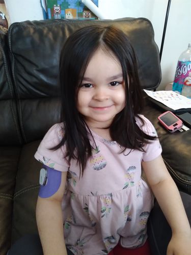 Customer photo review of Skin Grip Original - Dexcom G6 Patches