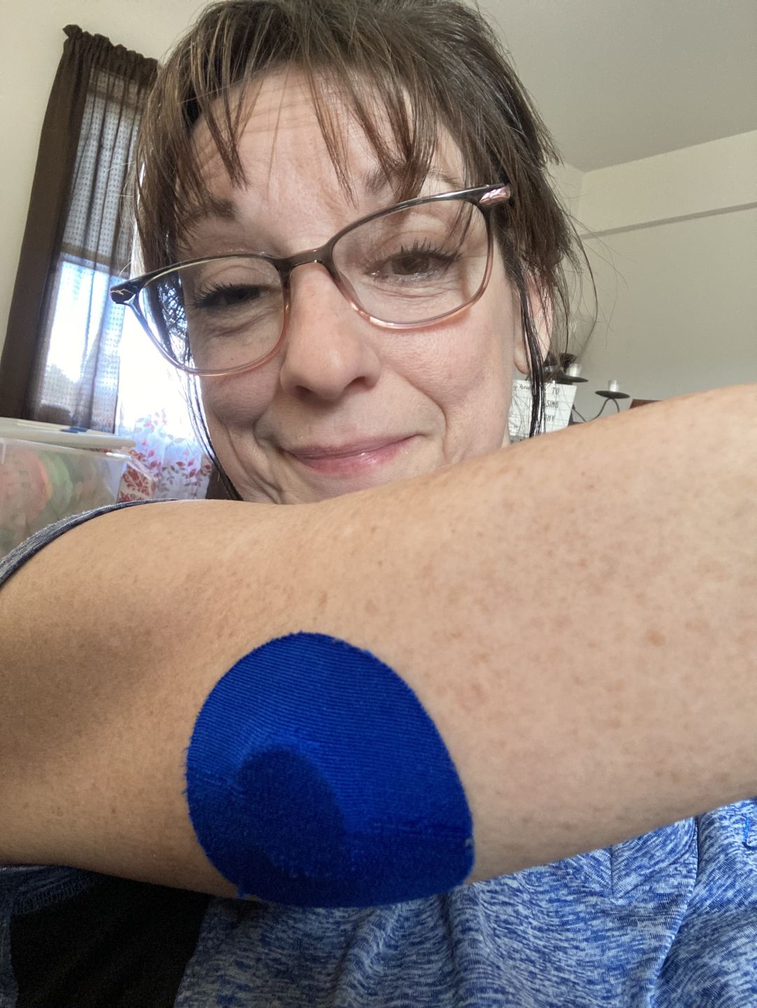 Customer photo review of Skin Grip Original - Freestyle Libre Adhesive Patches