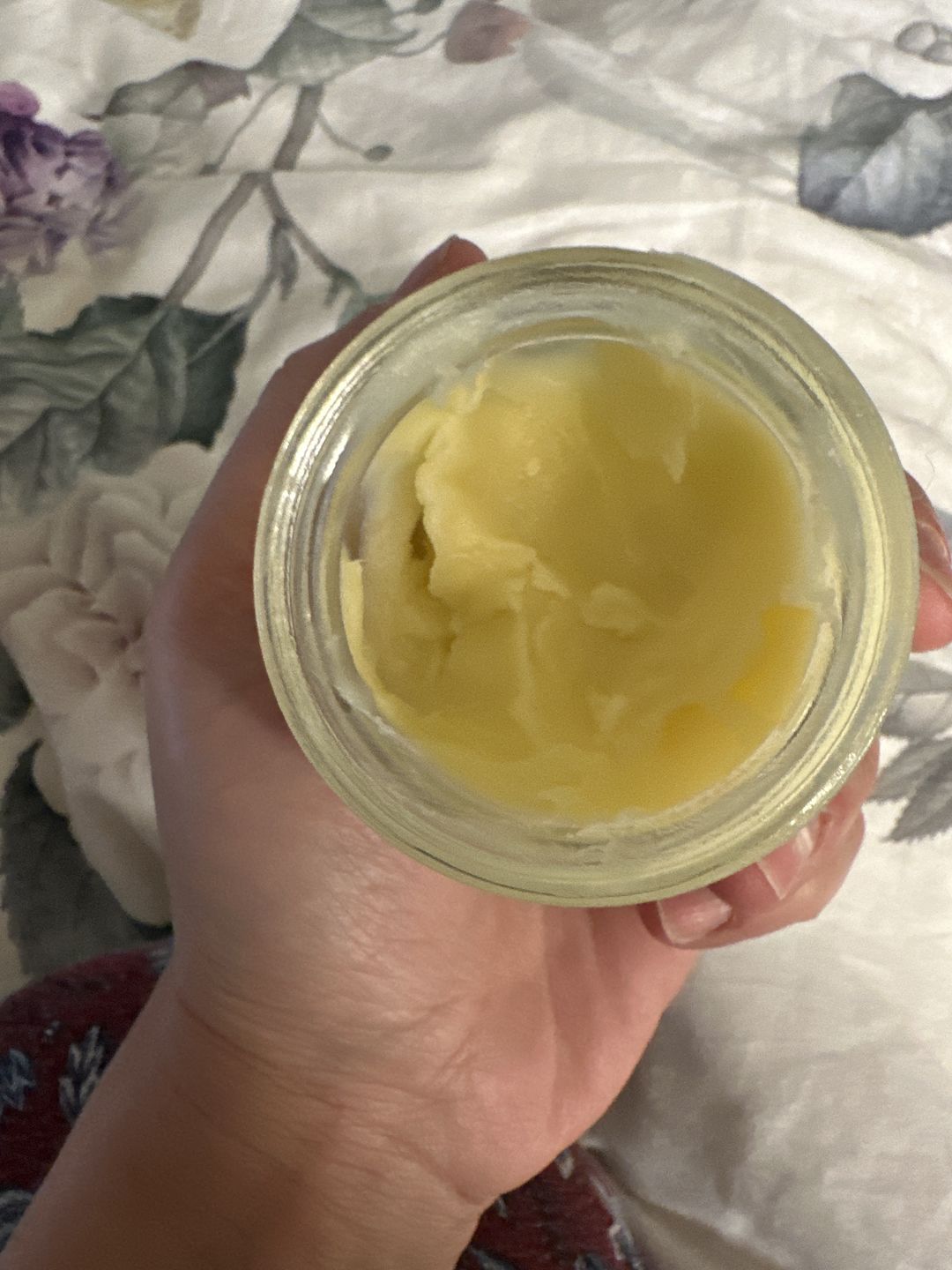 Customer photo review of Organic Barrier Balm