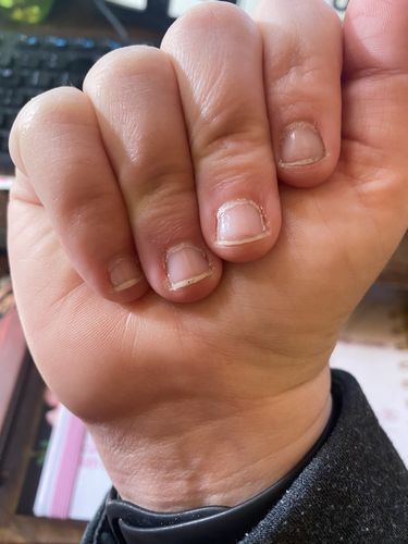 Customer photo review of Route Package Protection