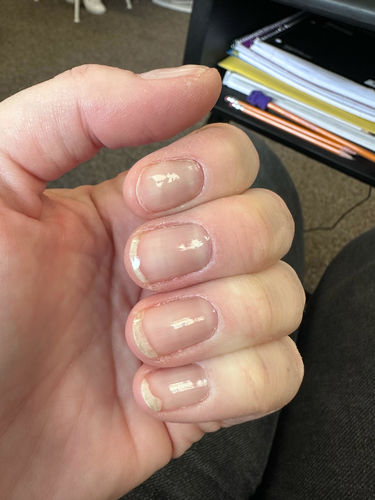 Customer photo review of Rocket Nail Fuel Starter Kit