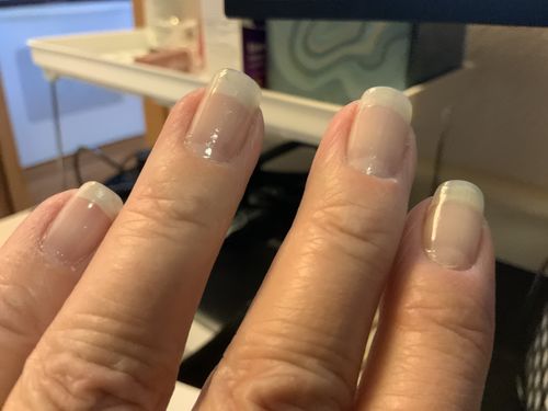 Customer photo review of The Nail System