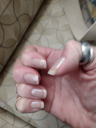 Customer photo review of Rocket Nail Fuel Nail Repair - Clear