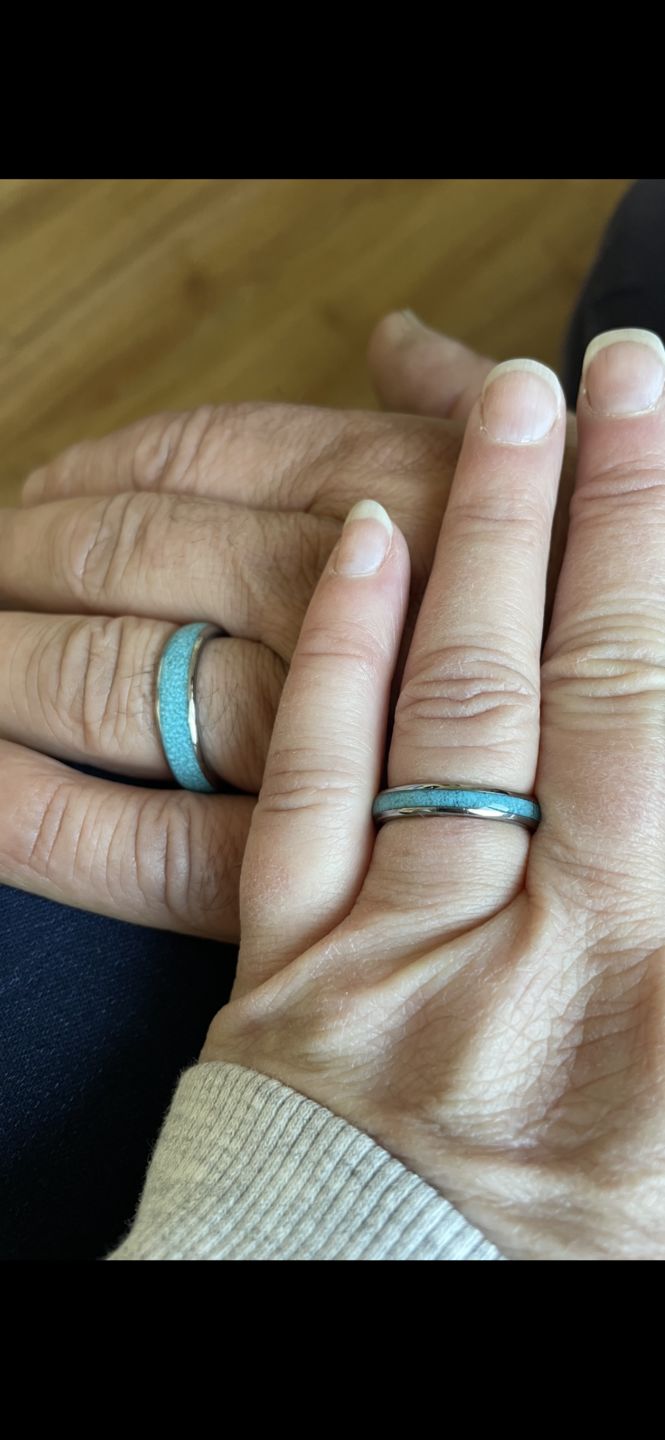 Customer photo review of The Turquoise Wonder Ring Set