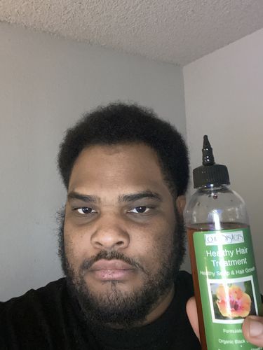 Customer photo review of Healthy Hair and Scalp Treatment