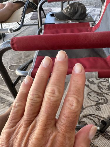 Customer photo review of Route Package Protection