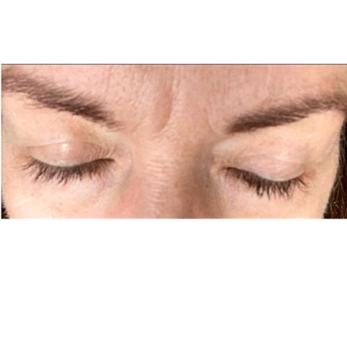 Customer photo review of SHOW LASH
