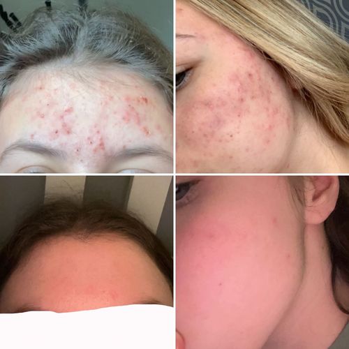 Customer photo review of Multi Strain Biotic