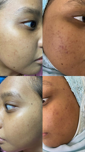 Customer photo review of Brightening Face Creme Travel