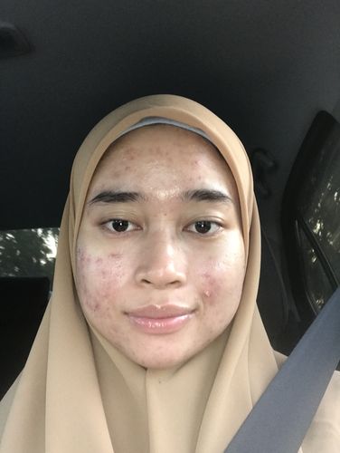 Customer photo review of Water Gel UV Sunscreen