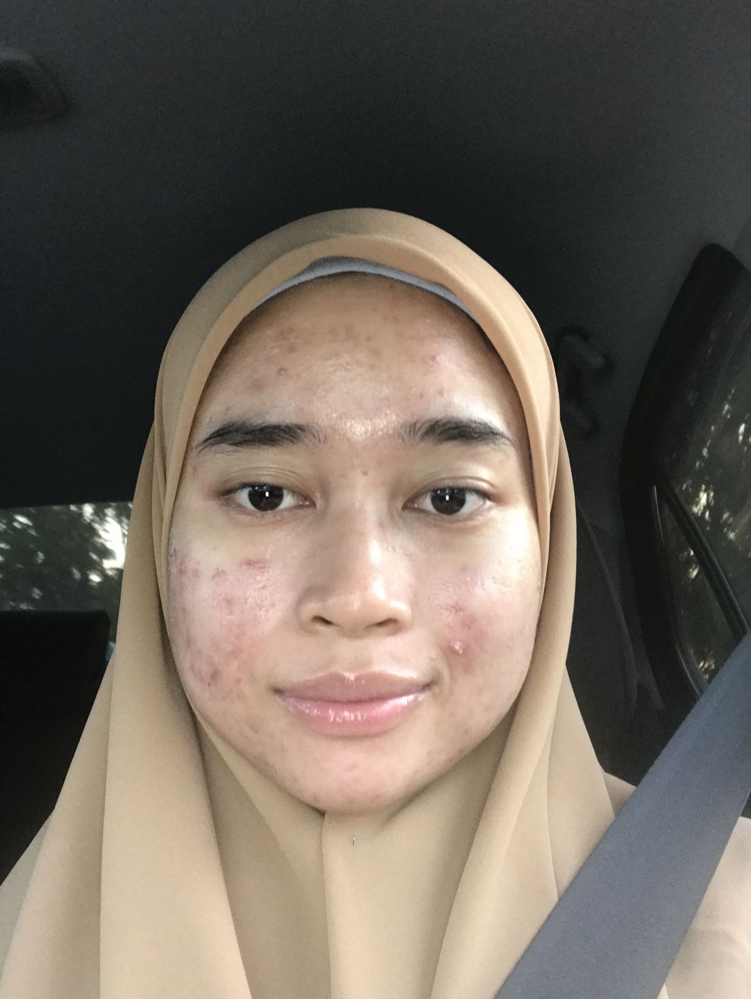 Customer photo review of Water Gel UV Sunscreen