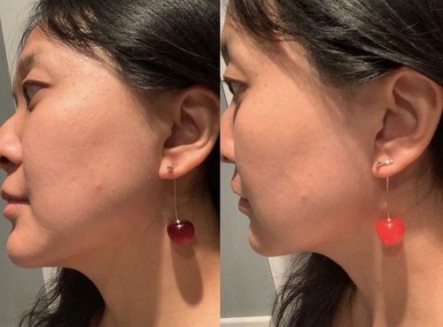 Customer photo review of Faisly™ - Cherry Earrings