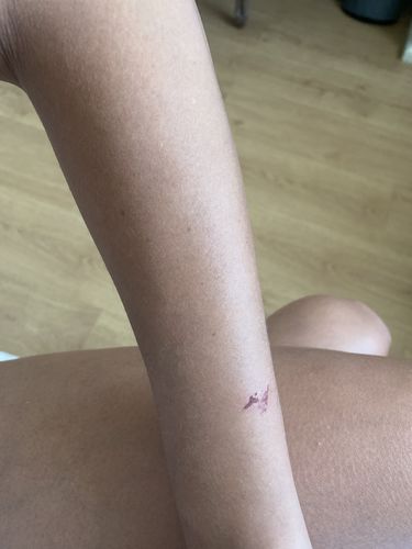 Customer photo review of Depilador Nuva Skin®
