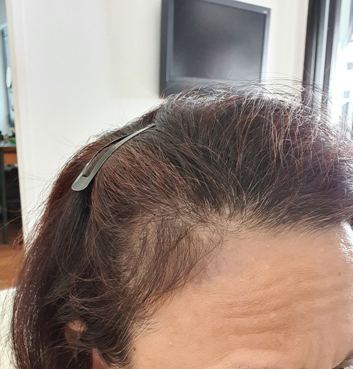 Customer photo review of [ SMIB ] - 500ML Coral Calcium Treatment