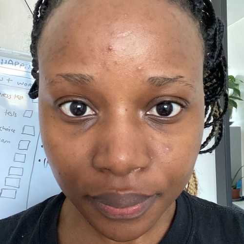 Customer photo review of Skin Glow Kit