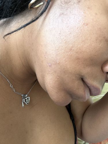 Customer photo review of Skin Glow Kit
