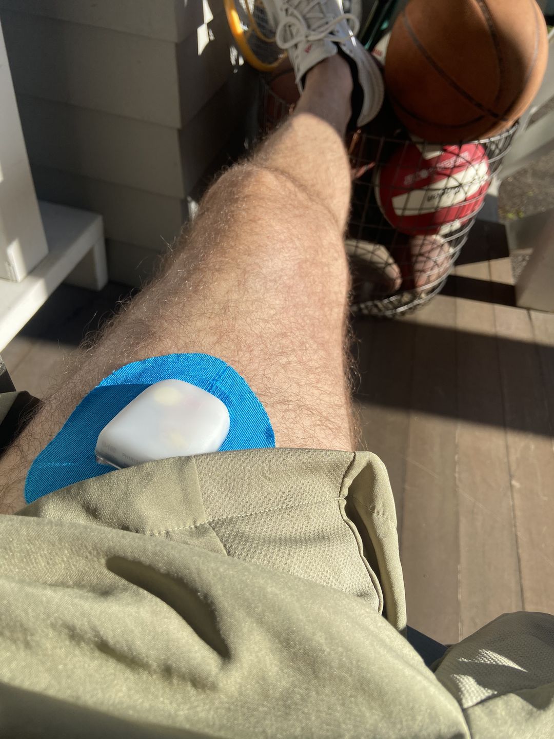 Customer photo review of Skin Grip Original - Omnipod Adhesive Patches