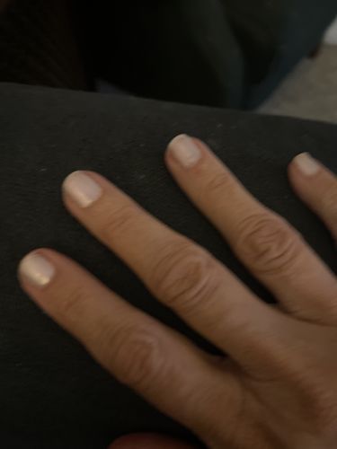 Customer photo review of The Nail System