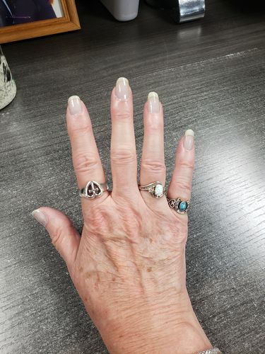 Customer photo review of Rocket Nail Fuel Nail Repair - Clear