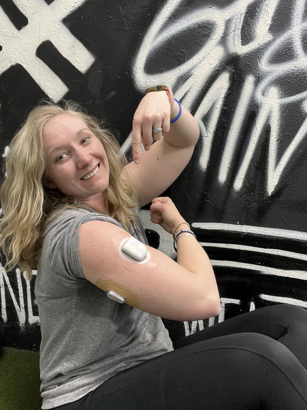 Customer photo review of Skin Grip MAX Dexcom G6 Patches