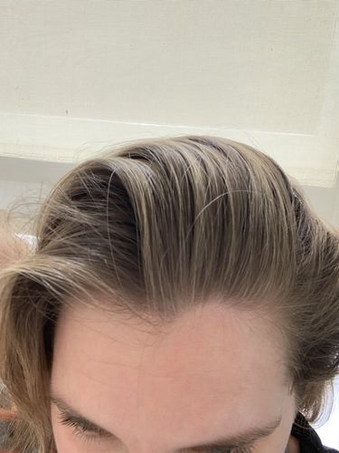 Customer photo review of Day After Brush Clean Dry Shampoo