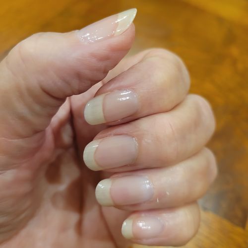 Customer photo review of Rocket Nail Fuel Nail Repair - Clear