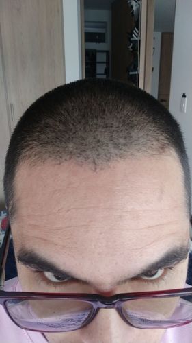 Customer photo review of ESCENCIAL PACK PRO - MyHUEVOS®