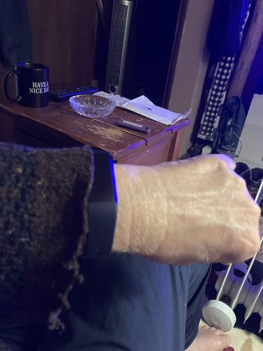 Customer photo review of Waterproof Smart Watch - Blood Pressure Monitor, Heart Rate Monitor, Sleep Monitor