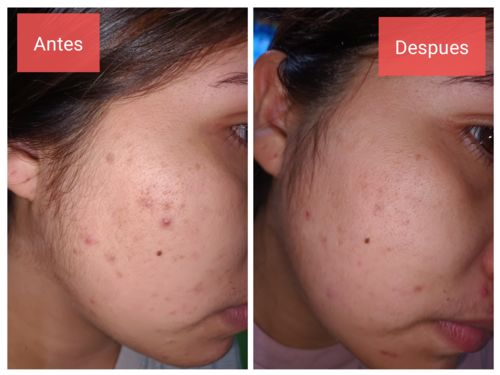 Customer photo review of Rutina Personalizada