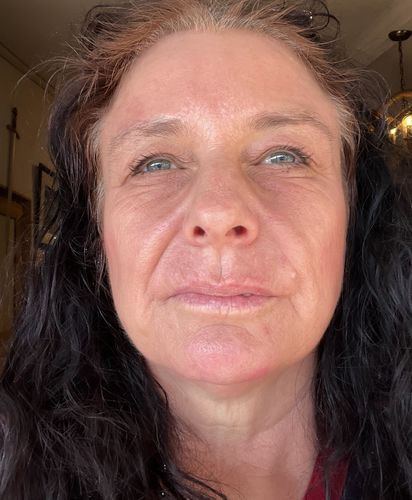 Customer photo review of Serum Pack of Three - Vitamin C, Hyaluronic Acid & Peptide Complex