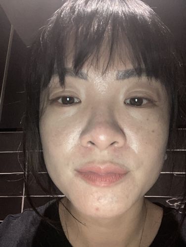 Customer photo review of Zobelle Glow LED Light Therapy Mask