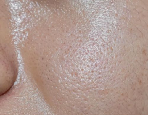 Customer photo review of Anti Aging Therapy: Age-Reverse & Beauty Products Frequencies