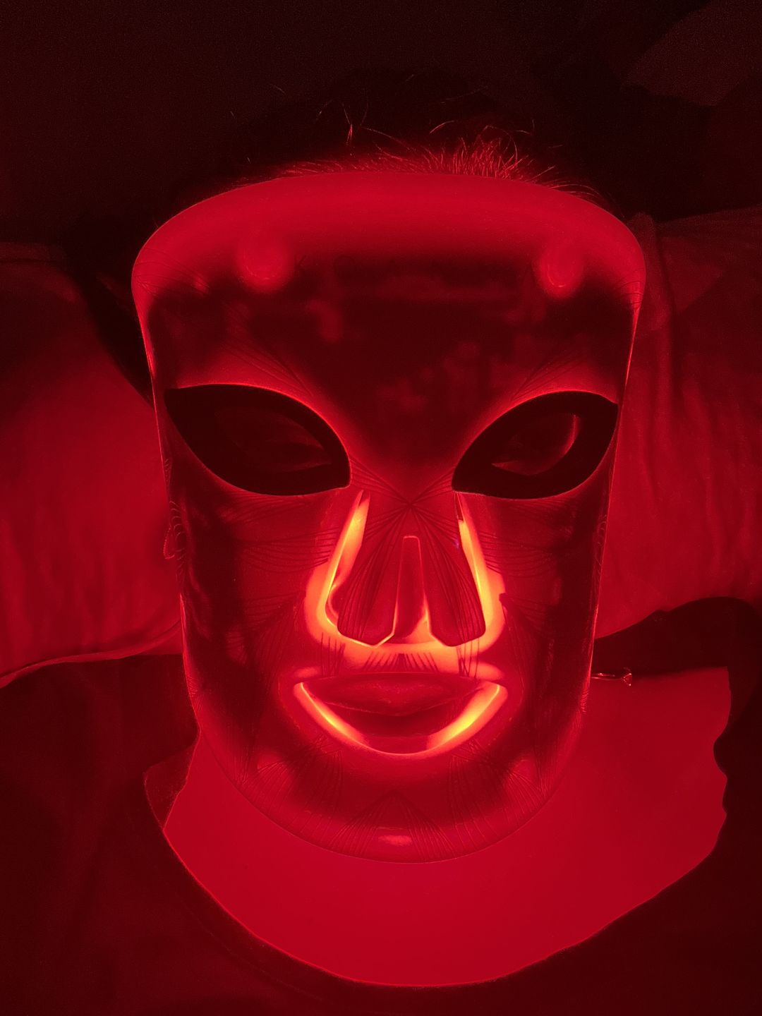 Customer photo review of LED Light Therapy Mask