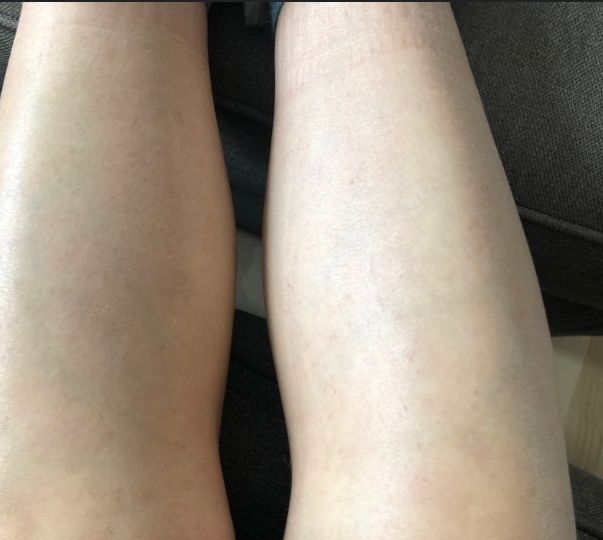 Customer photo review of Gomme Dépilatoire Gomépil™