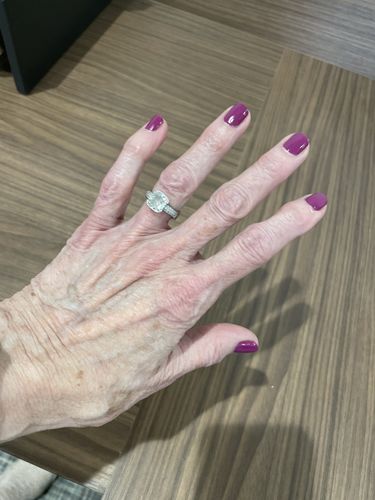 Customer photo review of The Nail System