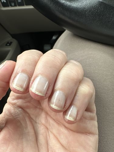 Customer photo review of Rocket Nail Fuel Nail Repair - Clear