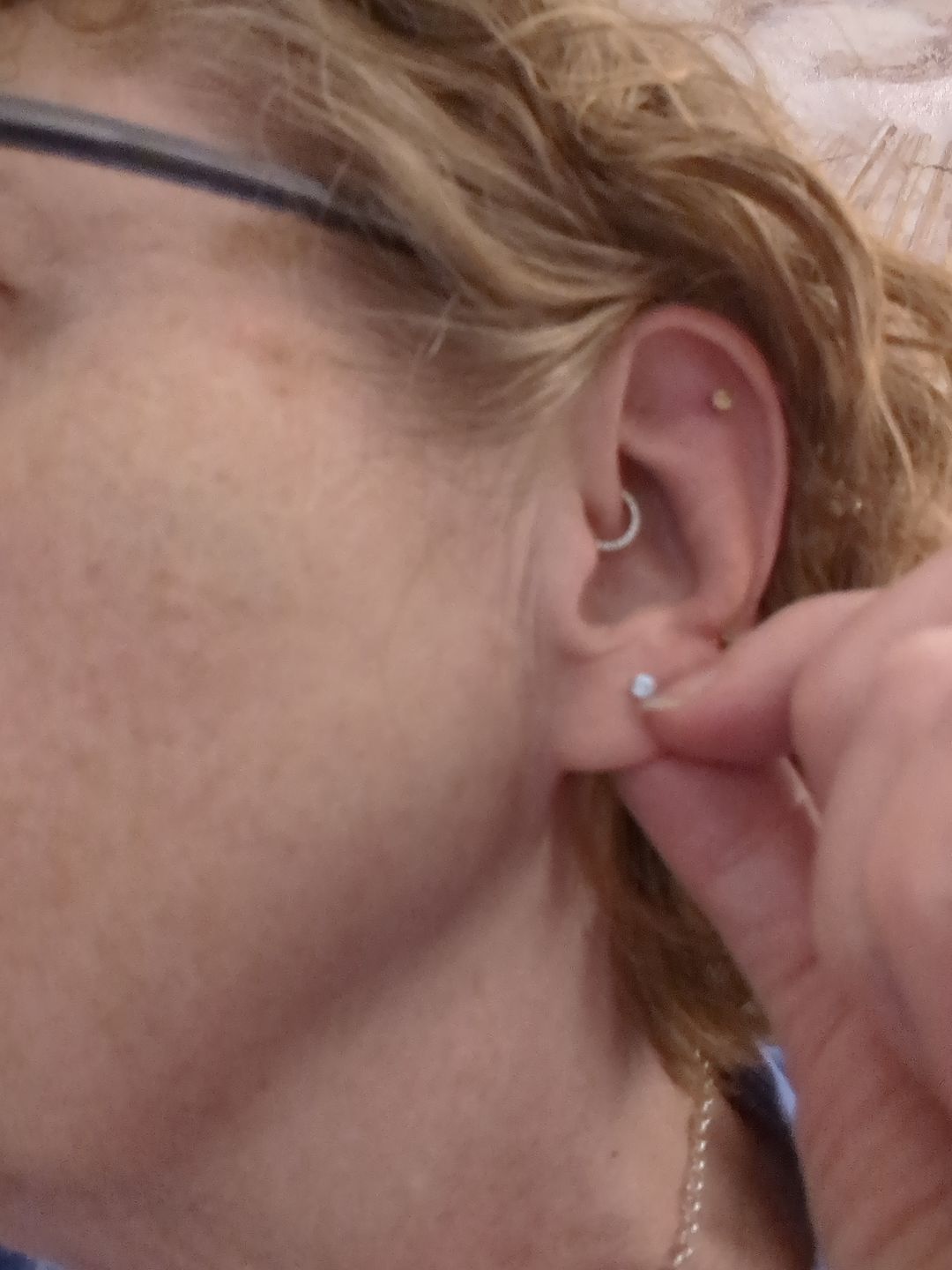 Customer photo review of Junipurr Titanium Flatback Labret Threadless