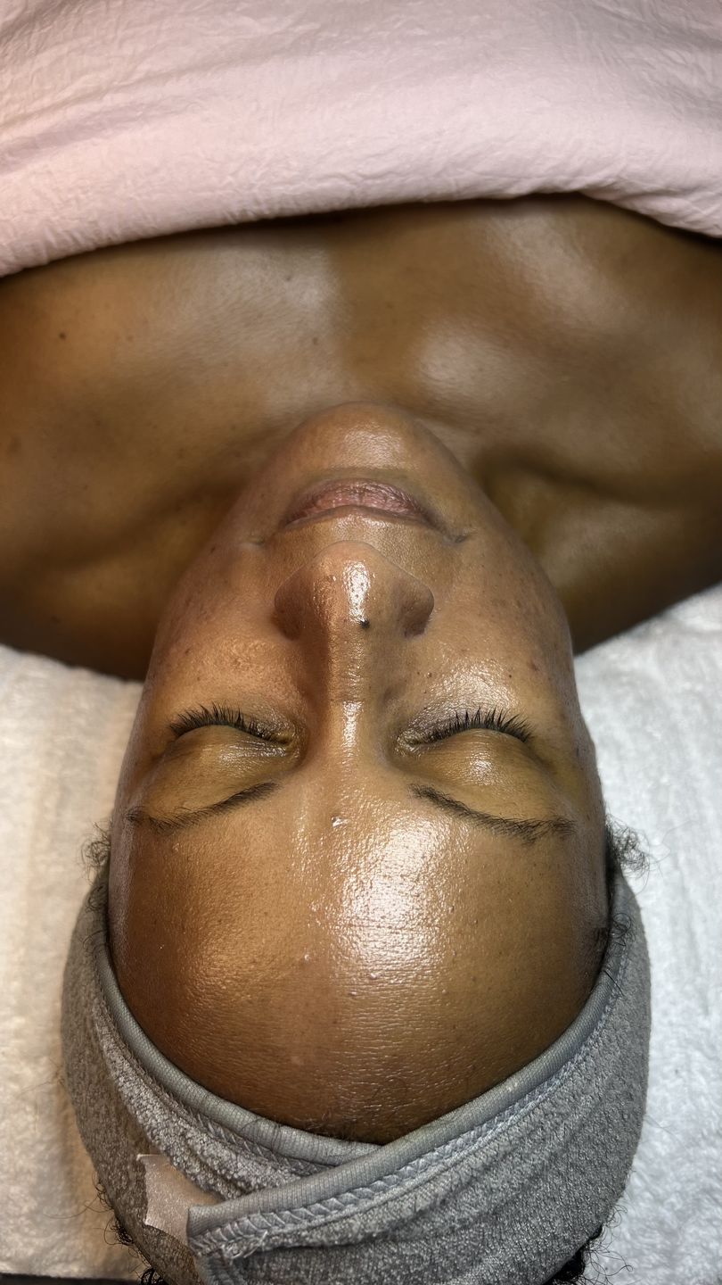 Customer photo review of Velo de seda de Péptido Mascarilla Facial  100% Natural