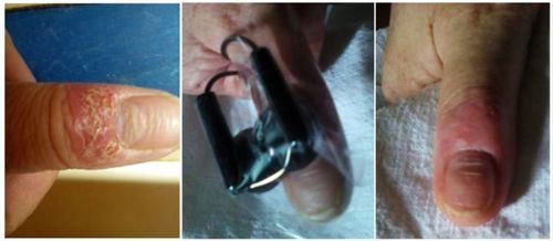 Customer photo review of Anti Aging Therapy: Age-Reverse & Beauty Products Frequencies