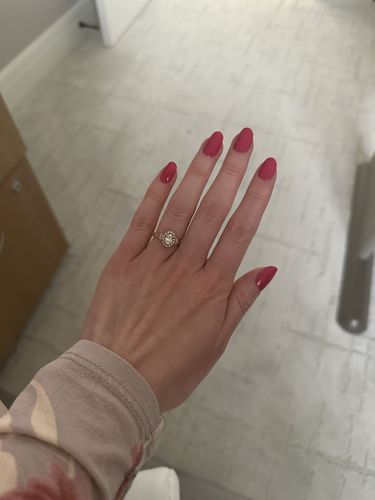 Customer photo review of Rocket Nail Fuel Starter Kit