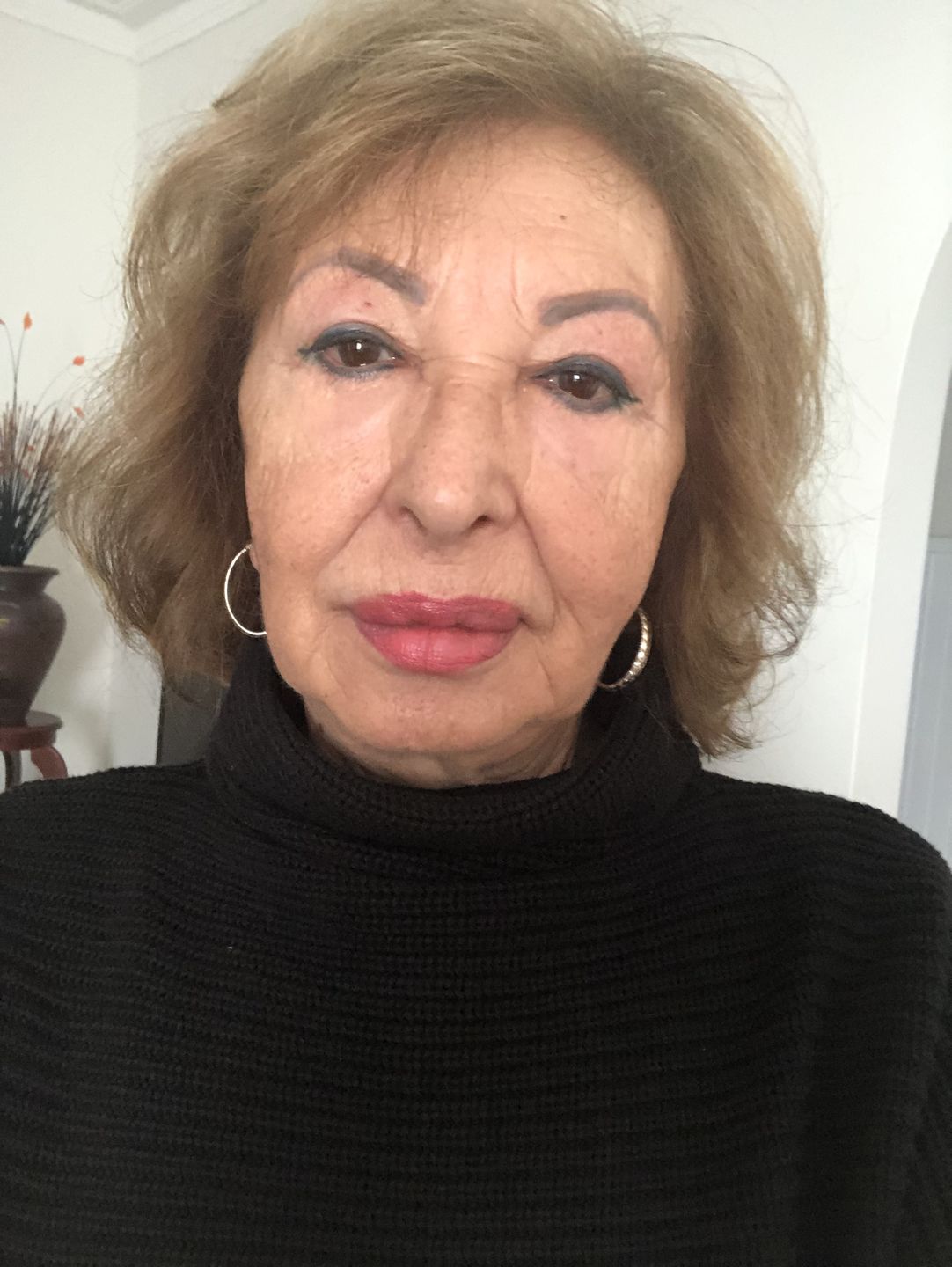 Customer photo review of SEA BUCKTHORN SERUM