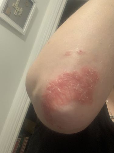 Customer photo review of Multi Strain Biotic
