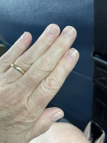 Customer photo review of Rocket Nail Fuel Nail Repair - Clear