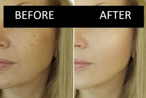 Customer photo review of Anti Aging Therapy: Age-Reverse & Beauty Products Frequencies