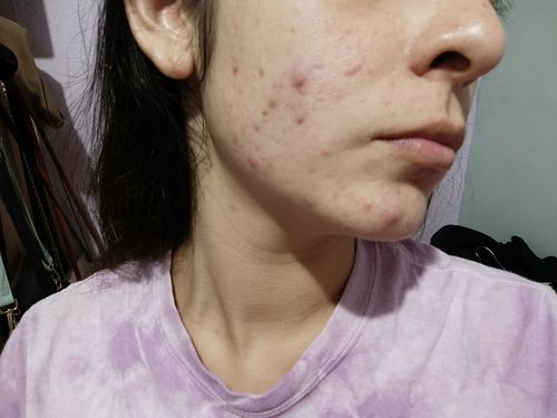 Customer photo review of Rutina Personalizada